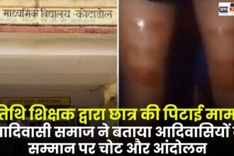 The Case of Beating Student by Guest Teacher in Manendragarh