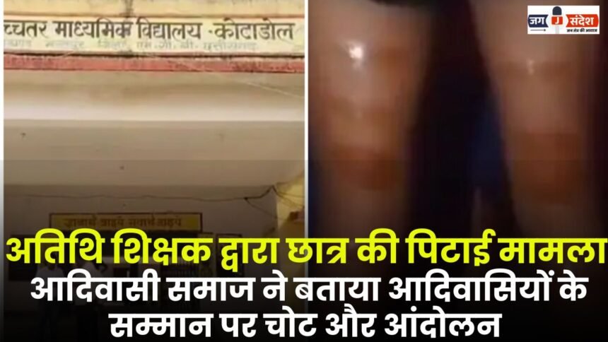 The Case of Beating Student by Guest Teacher in Manendragarh