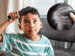 कम उम्र में बाल सफेद होने की बढ़ती समस्या: जानें कारण और बचाव के आसान उपाय : Growing Problem of Graying Hair at a Young Age 2 image 161
