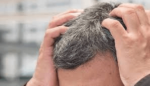 कम उम्र में बाल सफेद होने की बढ़ती समस्या: जानें कारण और बचाव के आसान उपाय : Growing Problem of Graying Hair at a Young Age 3 image 162