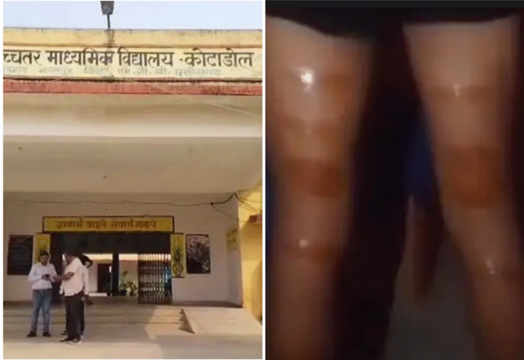 अतिथि शिक्षक द्वारा छात्र की पिटाई मामला ,आदिवासी समाज ने बताया आदिवासियों के सम्मान पर चोट और आंदोलन : The Case of Beating Student by Guest Teacher in Manendragarh 2 image 535