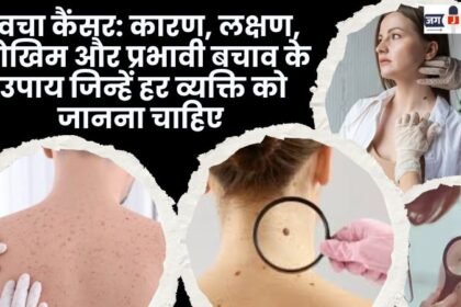 Skin Cancer Causes Symptoms Risks and Effective Preventive
