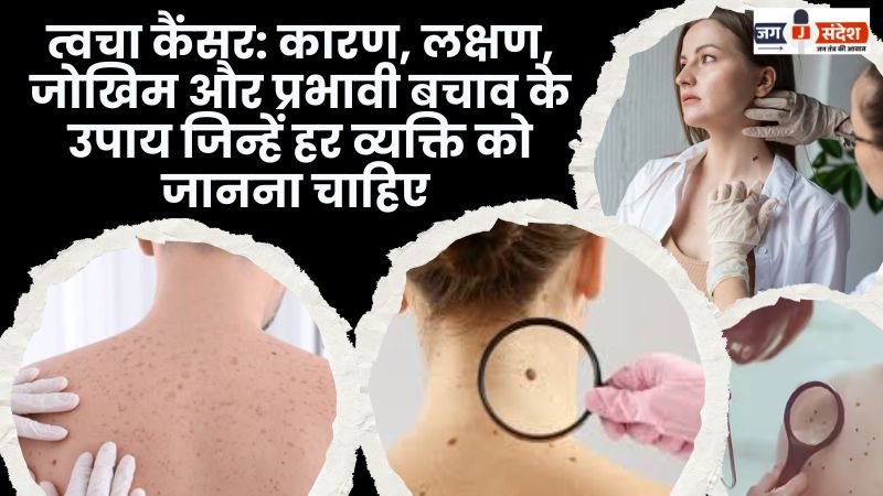Skin Cancer Causes Symptoms Risks and Effective Preventive