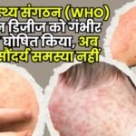 The World Health Organization has declared skin diseases a serious illness