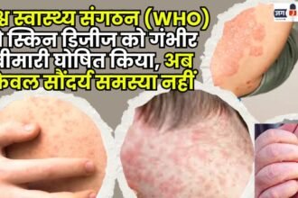 The World Health Organization has declared skin diseases a serious illness