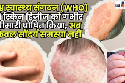 The World Health Organization has declared skin diseases a serious illness