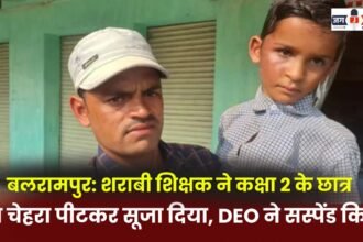 Balrampur: Drunk teacher beats Class 2 student causes swelling in his face