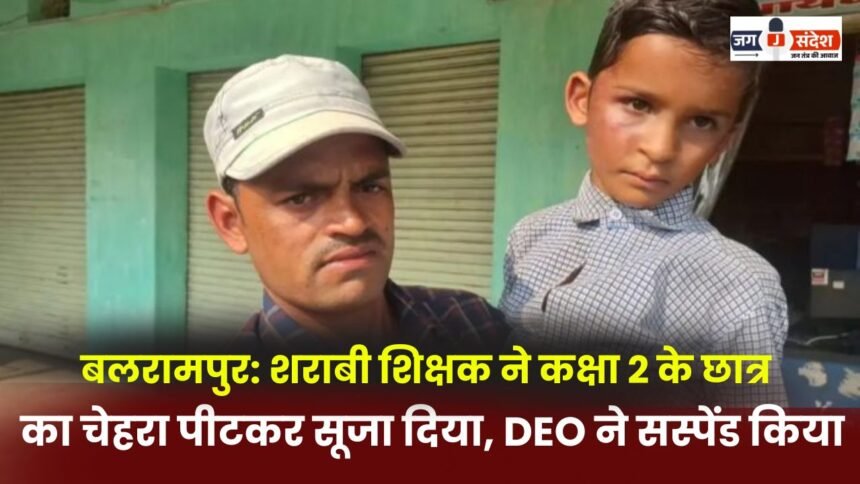 Balrampur: Drunk teacher beats Class 2 student causes swelling in his face