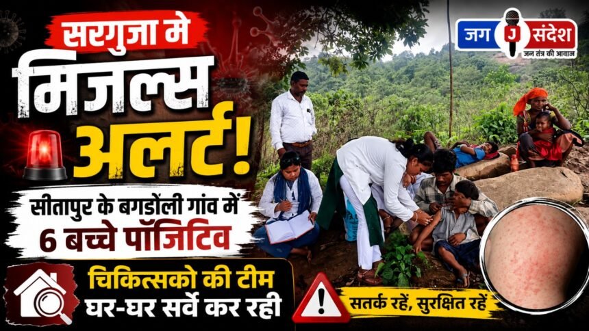 Measles alert in Surguja