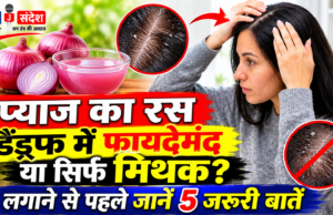 प्याज का रस डैंड्रफ में फायदेमंद या सिर्फ मिथक? लगाने से पहले जानें 5 जरूरी बातें Is onion juice beneficial for dandruff, or is it just a myth